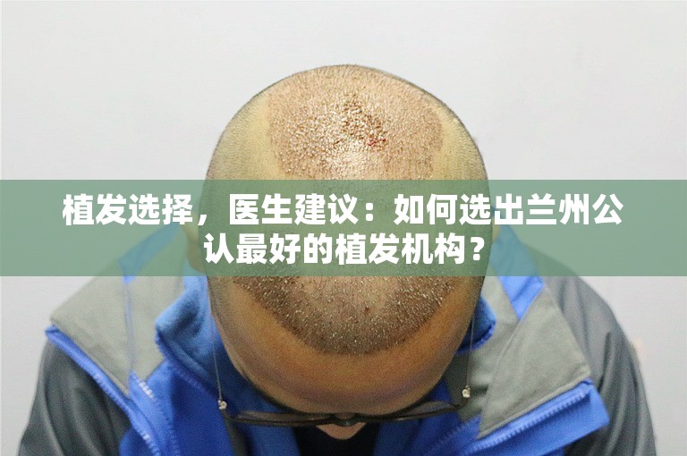 植发选择，医生建议：如何选出兰州公认最好的植发机构？