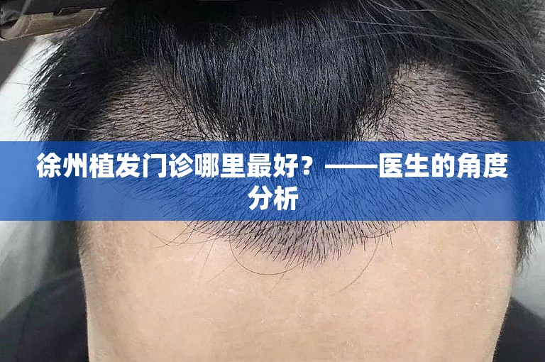 徐州植发门诊哪里最好？——医生的角度分析