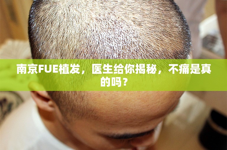 南京FUE植发，医生给你揭秘，不痛是真的吗？