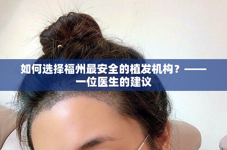 如何选择福州最安全的植发机构？——一位医生的建议