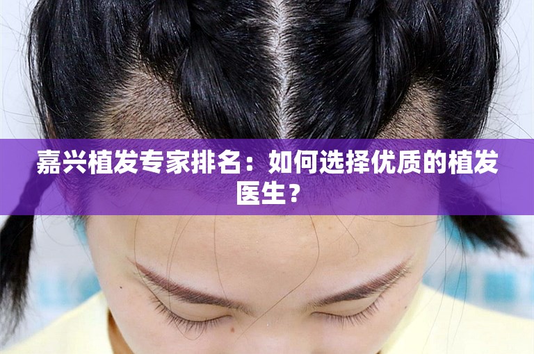 嘉兴植发专家排名：如何选择优质的植发医生？