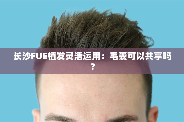 长沙FUE植发灵活运用：毛囊可以共享吗？