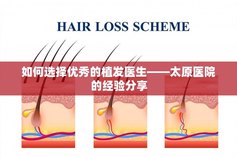 如何选择优秀的植发医生——太原医院的经验分享