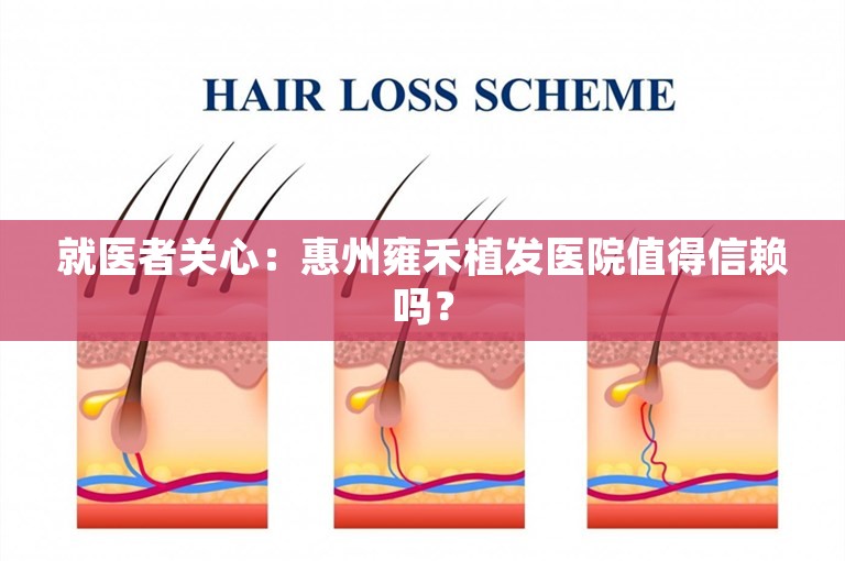 就医者关心：惠州雍禾植发医院值得信赖吗？