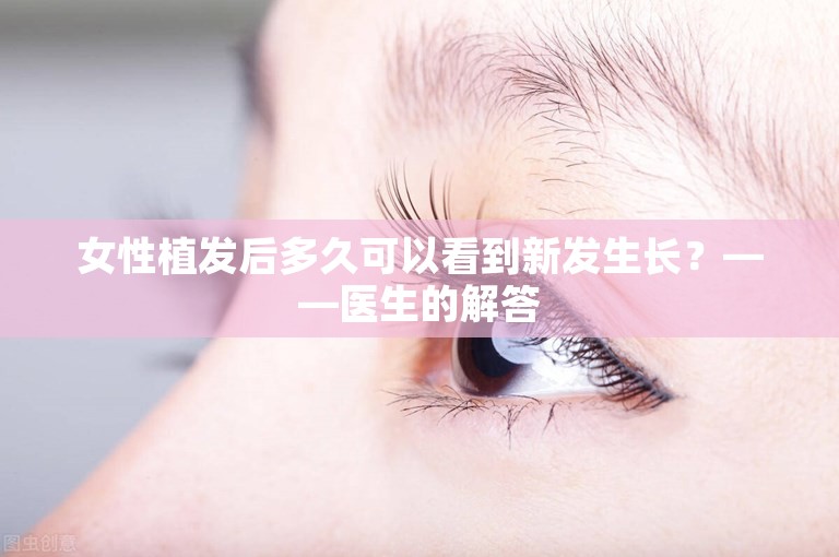 女性植发后多久可以看到新发生长？——医生的解答