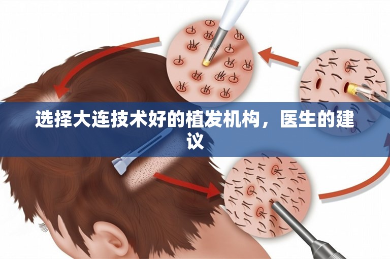 选择大连技术好的植发机构，医生的建议