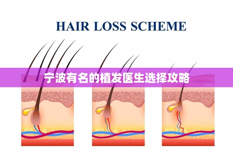 宁波有名的植发医生选择攻略