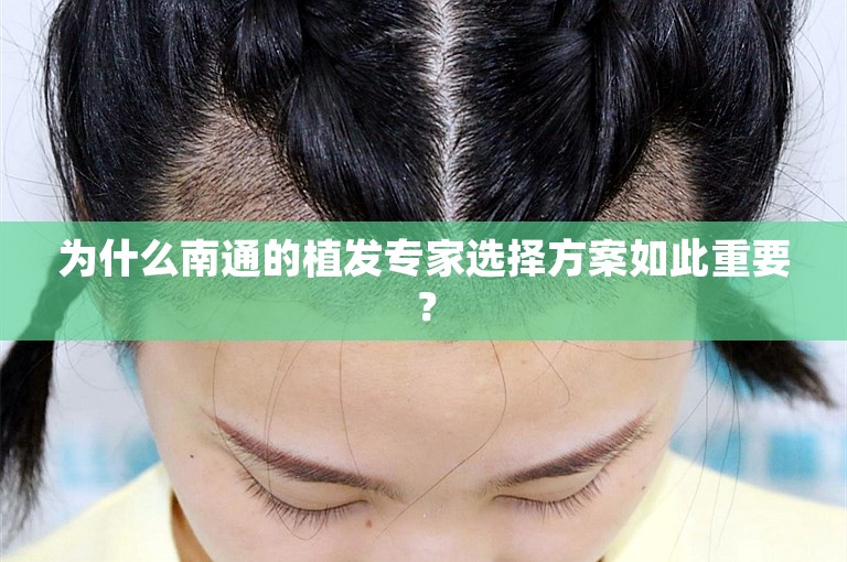 为什么南通的植发专家选择方案如此重要？