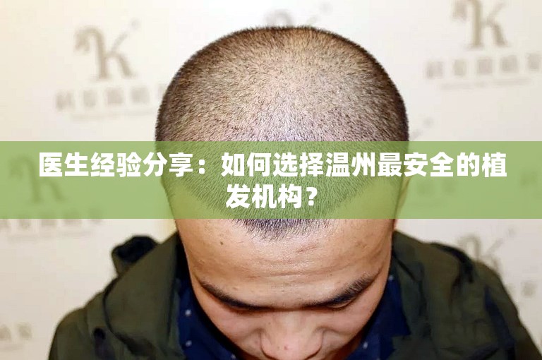 医生经验分享：如何选择温州最安全的植发机构？