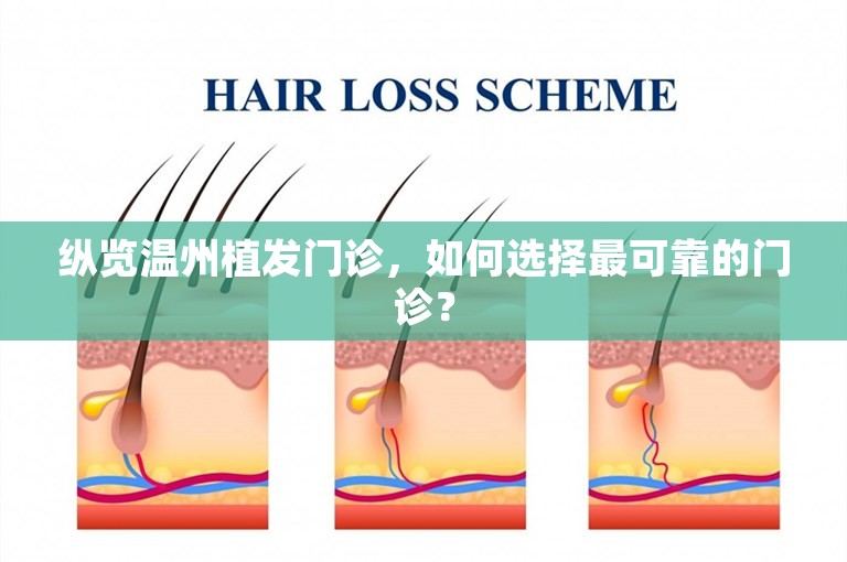 纵览温州植发门诊，如何选择最可靠的门诊？