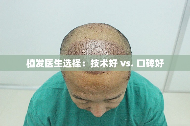 植发医生选择：技术好 vs. 口碑好