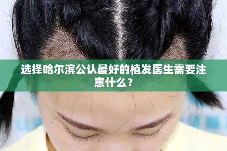 选择哈尔滨公认最好的植发医生需要注意什么？