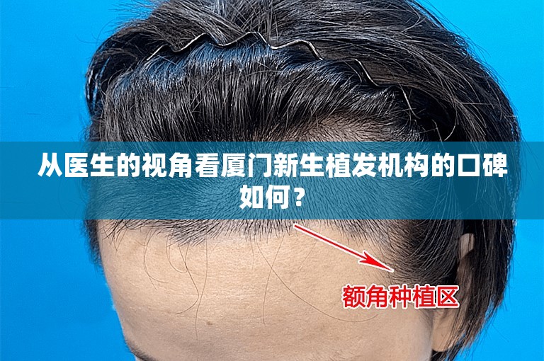 从医生的视角看厦门新生植发机构的口碑如何？