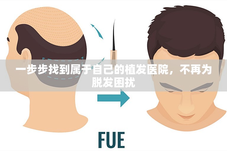 一步步找到属于自己的植发医院，不再为脱发困扰