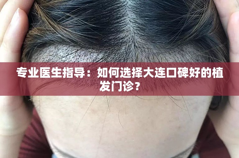 专业医生指导：如何选择大连口碑好的植发门诊？