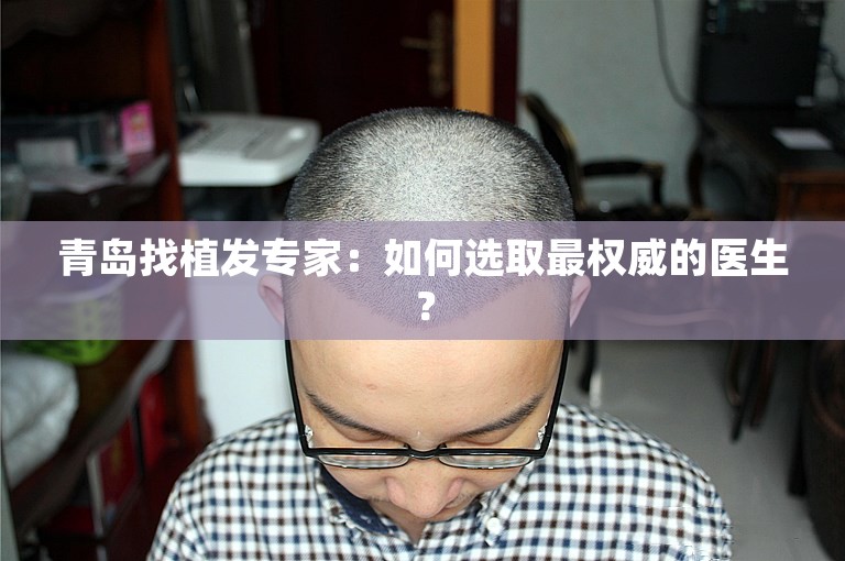 青岛找植发专家：如何选取最权威的医生？