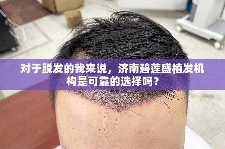 对于脱发的我来说，济南碧莲盛植发机构是可靠的选择吗？