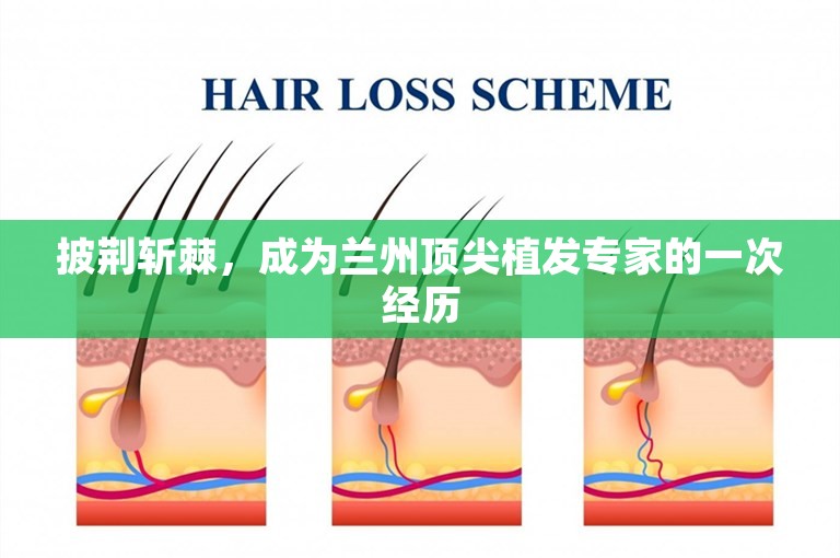披荆斩棘，成为兰州顶尖植发专家的一次经历