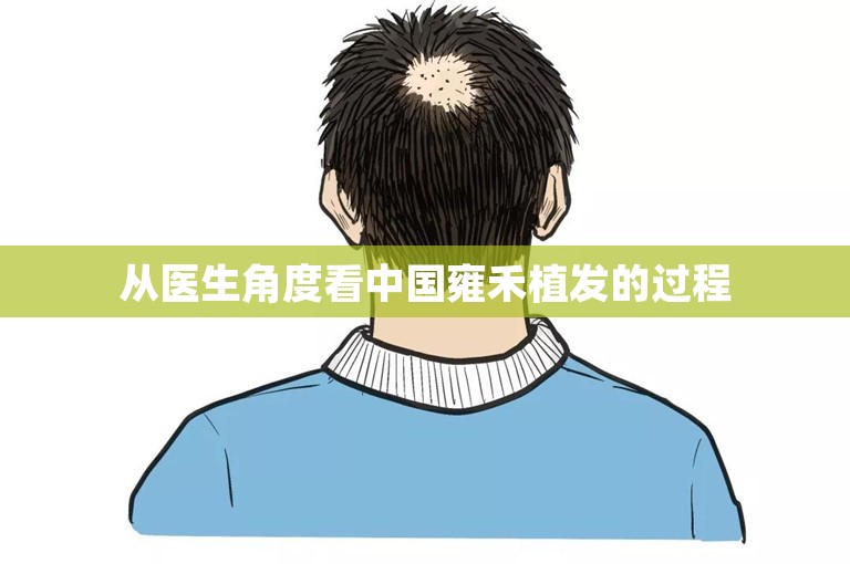 从医生角度看中国雍禾植发的过程