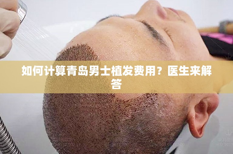 如何计算青岛男士植发费用？医生来解答