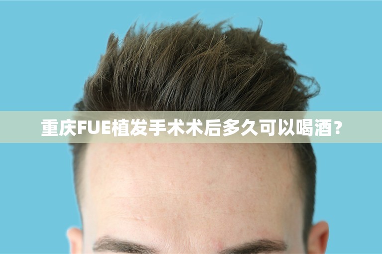 重庆FUE植发手术术后多久可以喝酒？