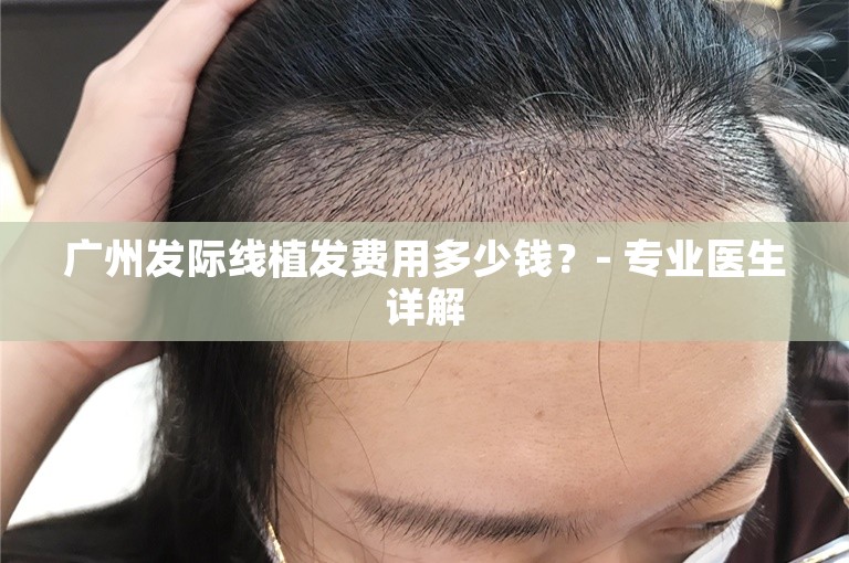 广州发际线植发费用多少钱？- 专业医生详解