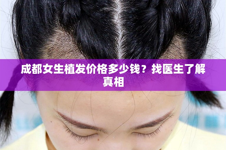 成都女生植发价格多少钱？找医生了解真相