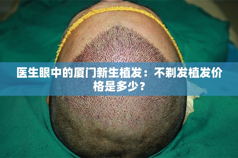 医生眼中的厦门新生植发：不剃发植发价格是多少？