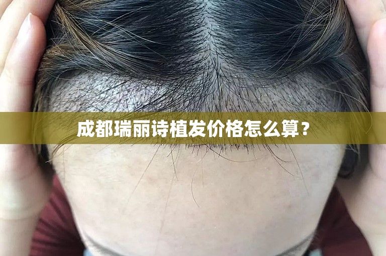 成都瑞丽诗植发价格怎么算？