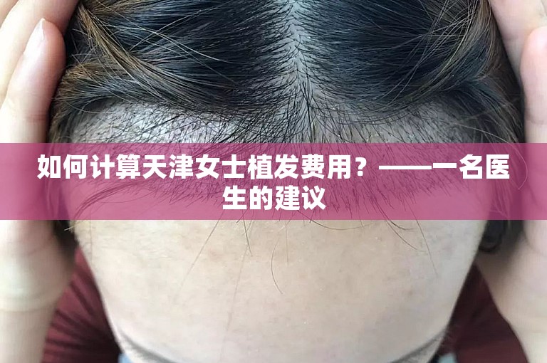 如何计算天津女士植发费用？——一名医生的建议