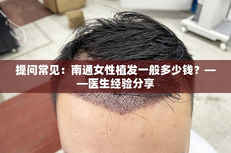 提问常见：南通女性植发一般多少钱？——医生经验分享