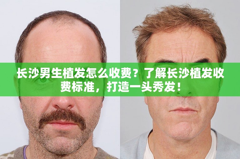 长沙男生植发怎么收费？了解长沙植发收费标准，打造一头秀发！