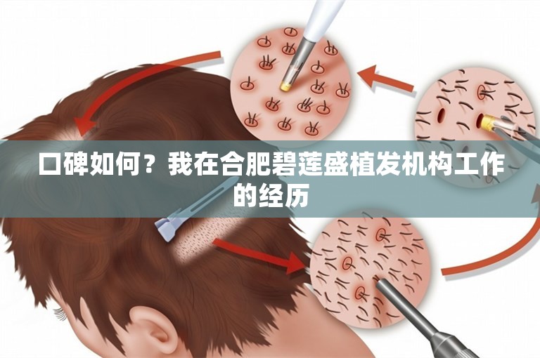 口碑如何？我在合肥碧莲盛植发机构工作的经历