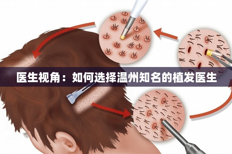 医生视角：如何选择温州知名的植发医生