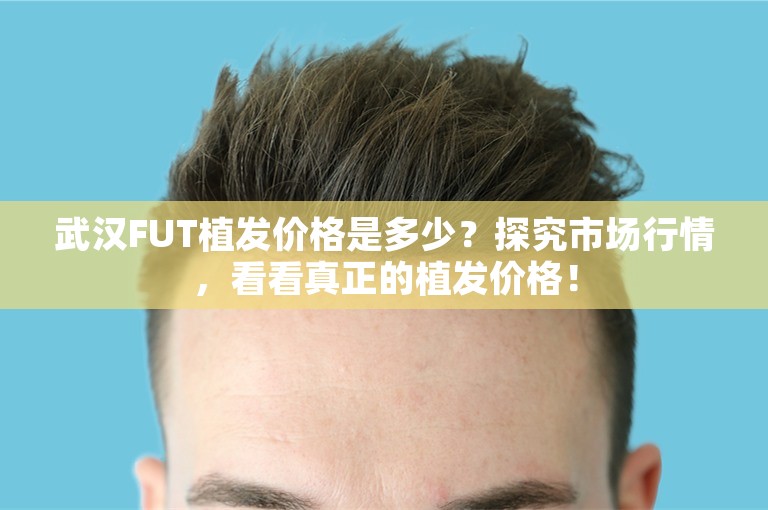 武汉FUT植发价格是多少？探究市场行情，看看真正的植发价格！