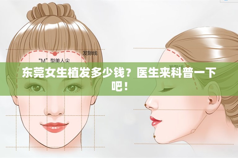 东莞女生植发多少钱？医生来科普一下吧！