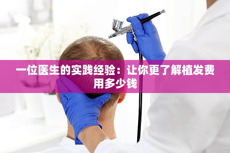 一位医生的实践经验：让你更了解植发费用多少钱