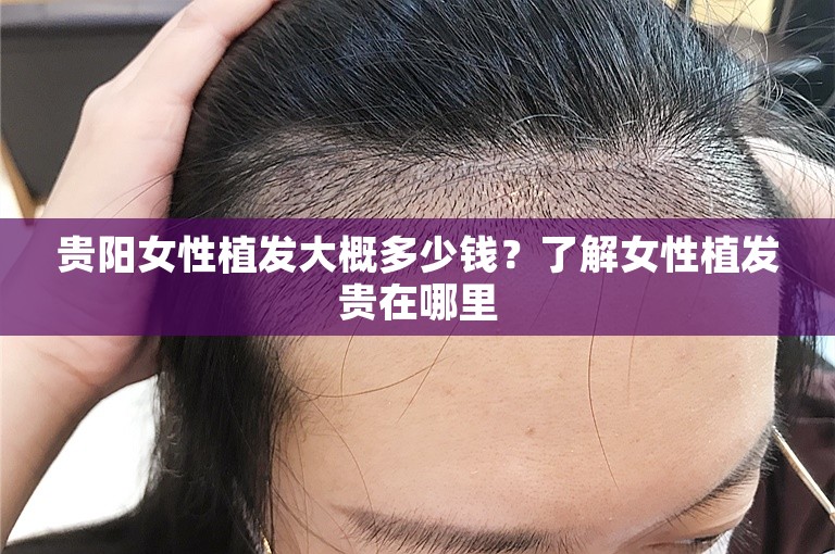 贵阳女性植发大概多少钱？了解女性植发贵在哪里