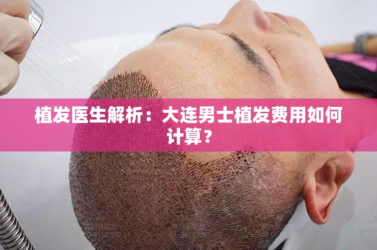 植发医生解析：大连男士植发费用如何计算？