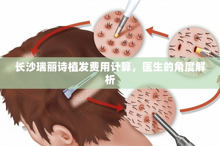 长沙瑞丽诗植发费用计算，医生的角度解析