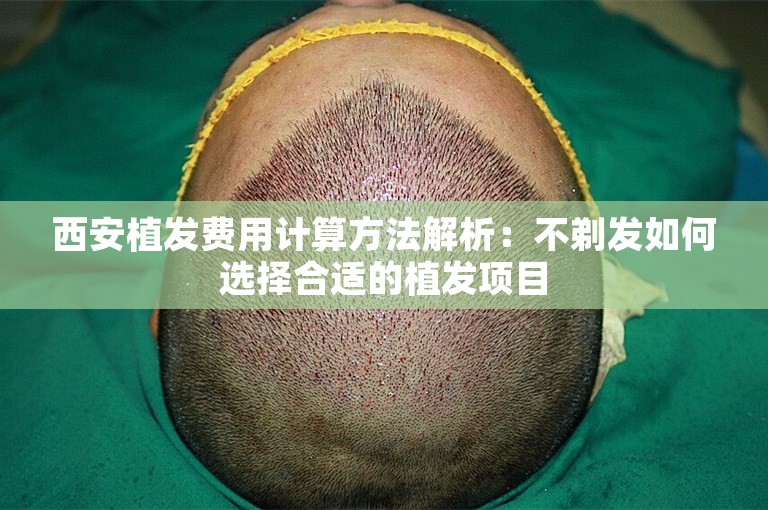 西安植发费用计算方法解析：不剃发如何选择合适的植发项目