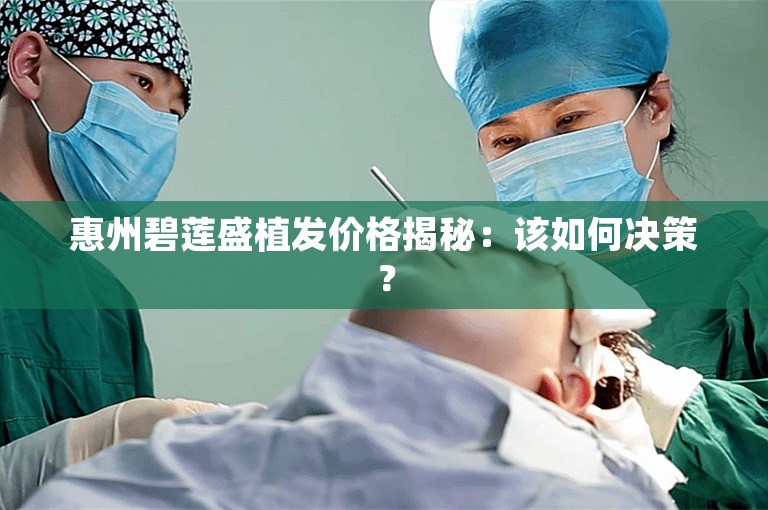 惠州碧莲盛植发价格揭秘：该如何决策？