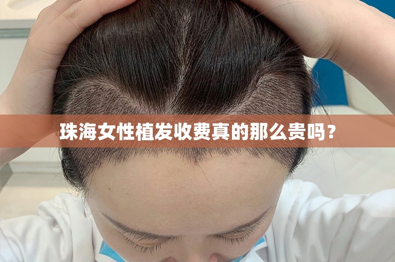 珠海女性植发收费真的那么贵吗？