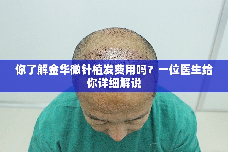 你了解金华微针植发费用吗？一位医生给你详细解说