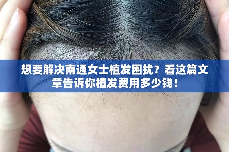 想要解决南通女士植发困扰？看这篇文章告诉你植发费用多少钱！