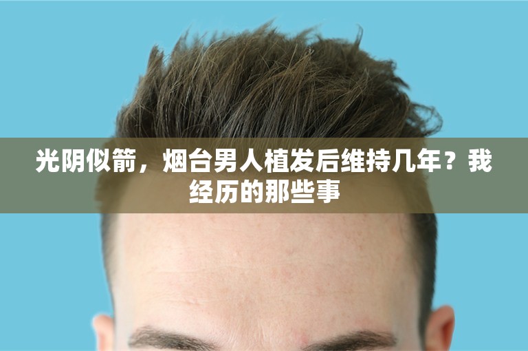 光阴似箭，烟台男人植发后维持几年？我经历的那些事