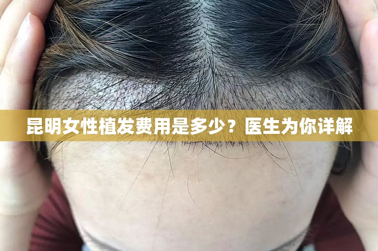 昆明女性植发费用是多少？医生为你详解