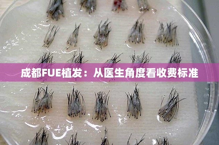 成都FUE植发：从医生角度看收费标准