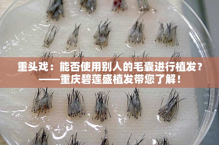 重头戏：能否使用别人的毛囊进行植发？——重庆碧莲盛植发带您了解！