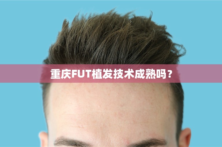 重庆FUT植发技术成熟吗？